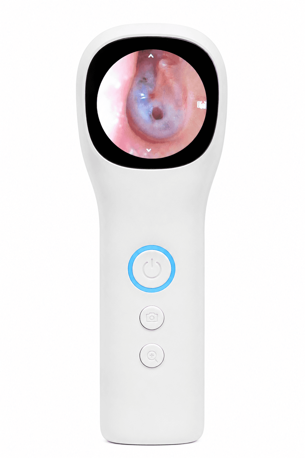 All In One Portable Digital Video Otoscope
