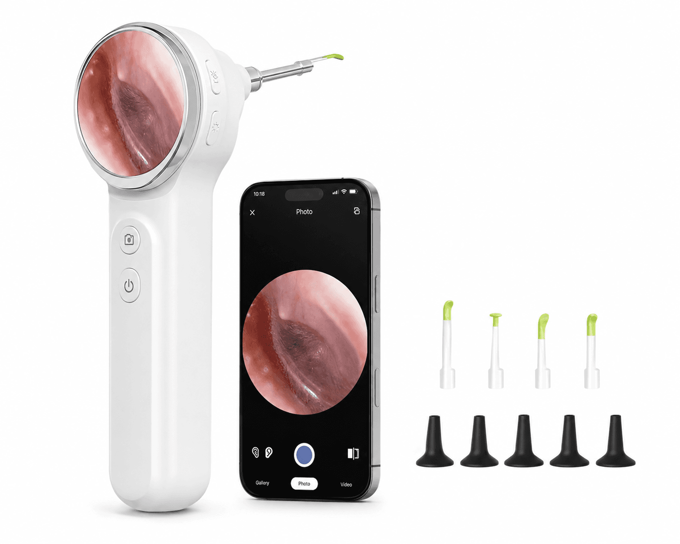 ScopeAround Wireless Video Otoscope